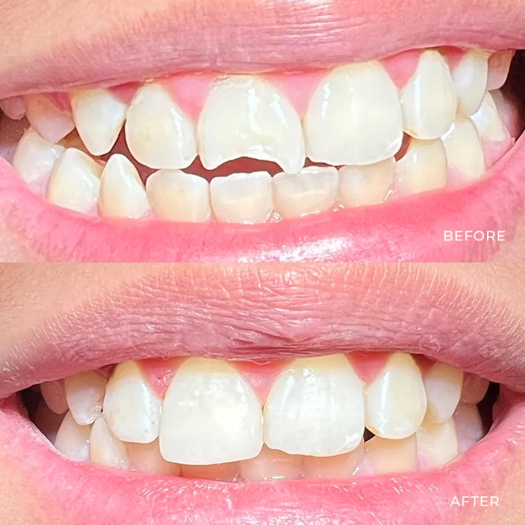 Cosmetic Dentistry